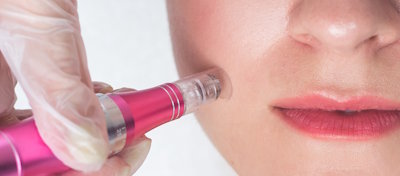 skin-needling-course-2-sm