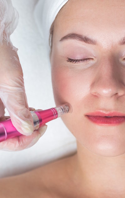 skin-needling-course-2